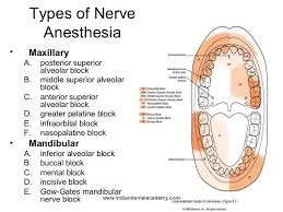 Local Anesthesia Injection Sites Google Search Dental