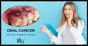 However, you can reduce your risk of mouth cancer if these technologies collect information to help us understand how our websites are being used and to. Oral Cancer All You Need To Know Sky Dental Care Hospital