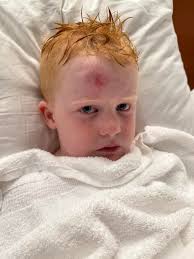 Williston ER sent home with untreated concussion