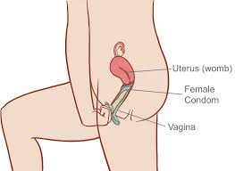 Female Condom Family Planning Victoria