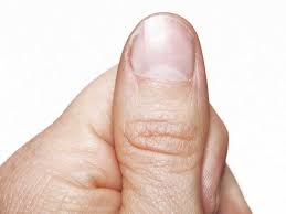 How to remove acrylic nails safely at. Nail Pitting Causes Treatment And More