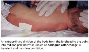 Image result for Harlequin Color Change