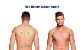 Bentuknya padat dan mirip seperti kerikil. Titik Bekam Angin Duduk Rumah Sehat Herba Holistic
