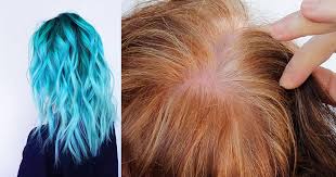 How do beets add color to your hair? Can Hair Dye Cause Hair Loss Hair Dye Side Effects Hello Lidy