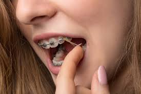 Flexibility of your neck and back can decrease due to as, and lead to morning stiffness, difficulty sleeping and inability to do normal daily activities such as getting dressed or bathing. Why Are There Rubber Bands On Braces Hawaii Family Dental