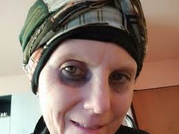 Como, la donna malata di cancro che cercava la madre per curarsi ora chiede  aiuto al padre biologico