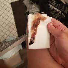 Eher so wie eine sehr sehr leichte regelblutung nur das es halt statt hey ich lese in mehreren foren wo es um schwangerschaft /geburt geht oft was über schleimpfropf abgang. Schleimpfropf Abgang In Der 34 Ssw Schwangerschaftsgruppe Babycenter