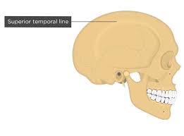 Image result for Parietal Bone