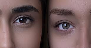 If you pay per unit, the cost will. Are You Complaining Botox Didn T Work On Me Qazi Clinic Irvine Ca