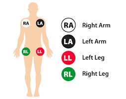 Learn about what conditions can be diagnosed through this test. 12 Lead Ecg Placement Guide With Illustrations