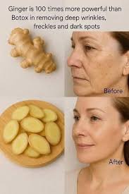 Ginger recipe for wrinkles and dark spots
