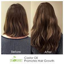 Hair experts weigh in on the miracle ingredient. Sky Organics Castor Oil 16oz Usda Organic Cold Pressed 100 Pure Hexane Free Castor Oil Moisturizing Healing For Dry Skin Hair Growth For Skin Hair Care Eyelashes Caster Oil Lazada Singapore
