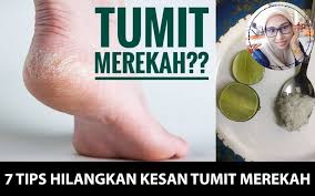 Ada cara lebih selamat selain ubat. Petua Untuk Mengelakkan Tumit Merekah Dan Berwarna Hitam Memang Menjadi Islam Itu Indah