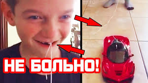 10 Bezumnyh Sposobov Vyrvat Zub Chast 2 Youtube