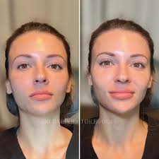 Medsomma Wellness + Nurse Injector Brooke