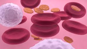 Thrombocytopenia is when you don't have enough platelets, cells in your blood that stick together to help it clot. Thrombozyten Zu Niedrig Das Mussen Sie Wissen Focus De