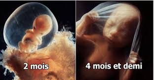 Epingle Sur Bebe