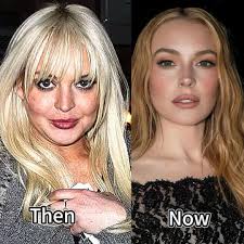 Lindsay Lohan Now Real