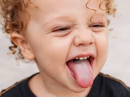 Image result for yellow tongue infection
