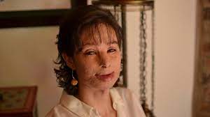 El influencer participó el año pasado en el cantando y su carisma y manejo de la pista lo llevaron. Colombian Acid Attack Victim Natalia Ponce S Long Recovery Bbc News