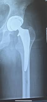 Normal knee xray - sarman.si