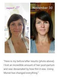 Monat Helps Postpartum Hair Loss Https Crownofglory1 Mymonat Com Monat Hair Postpartum Hair Loss Monat