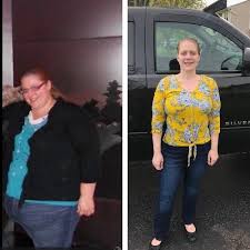 Bariatric Surgery And Weight Loss Niagara Falls Memorial Medical Center