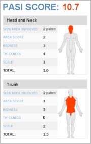 psoriasis area and severity index pasi training