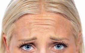 How to get rid of worry lines. What Are Frown Lines All You Should Know About Frown Lines Skinkraft