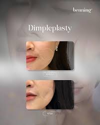 Filler Botox Coolsculpting (@benningaesthetic) · Surakarta