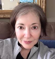 Hair growth after chemotherapy experiences and advice