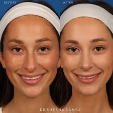 🙏🏼Beyond blessed to have been welcomed with open arms and hearts by Dr. Keith  Marcus, his amazing team, and the South Bay community. Thank you all for an  incredible year ❤️ @drkeithmarcus @