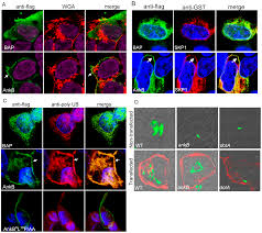 Legionnaires' disease is a serious type of pneumonia caused by legionella bacteria. Plos Pathogens Molecular Mimicry By An F Box Effector Of Legionella Pneumophila Hijacks A Conserved Polyubiquitination Machinery Within Macrophages And Protozoa