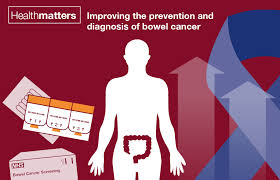How do you know if you have it? Health Matters Bowel Cancer Behind The Data Public Health Matters