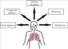 In this article how common is copd? Chronic Obstructive Pulmonary Disease British Society For Immunology