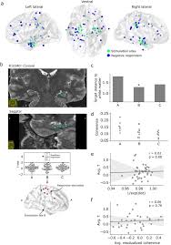 6 healthcare dr ste 2. Theta Burst Stimulation Entrains Frequency Specific Oscillatory Responses Brain Stimulation Basic Translational And Clinical Research In Neuromodulation