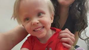 ‘We must move forward': Family loses 4-year-old to Coats plus syndrome, a  rare genetic disease