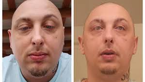 Fundraiser for Stephanie Fugate by Brandon Fugate : Support Brandon's  Health Journey