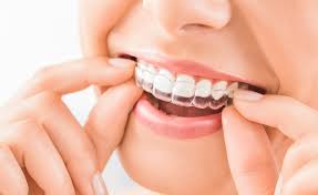 We did not find results for: Jenis Jenis Behel Itu Ternyata Banyak Loh Kenali Yuk Dentalosophy