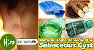 Want To Remove Sebaceous Cyst Naturally Without Any Surgical Procedure Then Try This Miraculous Remedy Remedies Essential Oils For Cysts Home Remedies For Acne