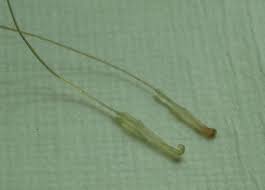 Blocked hair follicles symptoms begin with a lump that gradually becomes painful. If You Pull A Hair Out With The Follicle Can That Hair Still Grow Back Quora