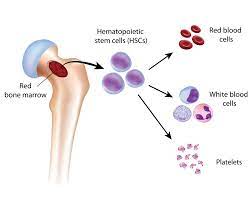 Check spelling or type a new query. Myelodysplastic Syndromes Mds Parkway Cancer Centre Uae