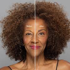 Billion Dollar Brow Lift®