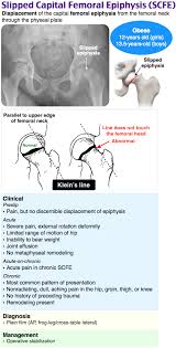 Rosh Review Human Anatomy And Physiology Medical Anatomy Medical Mnemonics