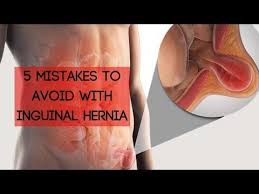 Feel the horizontal chain of nodes in the right groin just below the ligament (see above diagram). 5 Mistakes To Avoid With An Inguinal Hernia Youtube Hernia Exercises Hernia Inguinal Male Sexuality