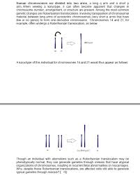 Most people with robertsonian translocations have only 45 chromosomes. Human Chromosomes Are Divided Into Two Arms A Long Q Chegg Com