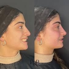 Dra Patricia Romero Pfaff