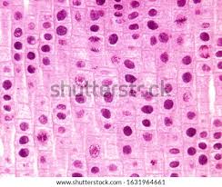 We did not find results for: Metaphase Plate Stock Photos And Images Avopix Com