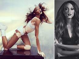 Maybe you would like to learn more about one of these? Chantelle Brown Young Topmodel Trotz Hautkrankheit Vitiligo Wunderweib