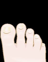 Image result for Akutní zánět nehtového lůžka